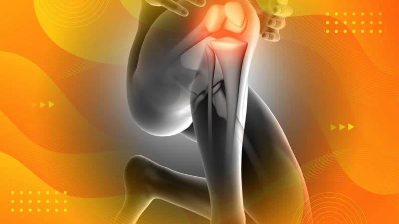 Comprehensive Timeline and Recovery Stages After Patella Fracture