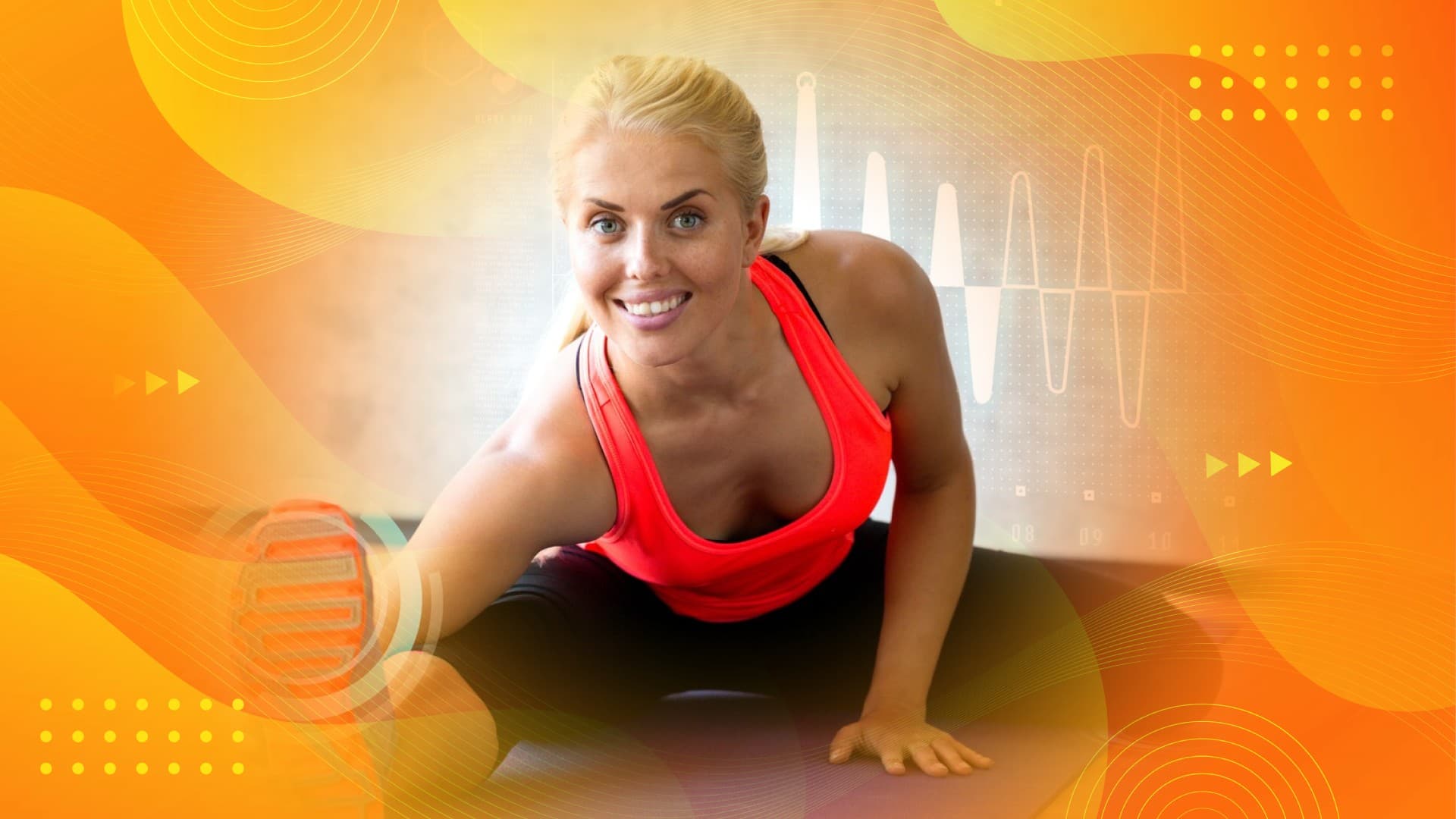 Arthrosamid Hydrogel Treatment Enhancing Mobility in Early Knee Osteoarthritis