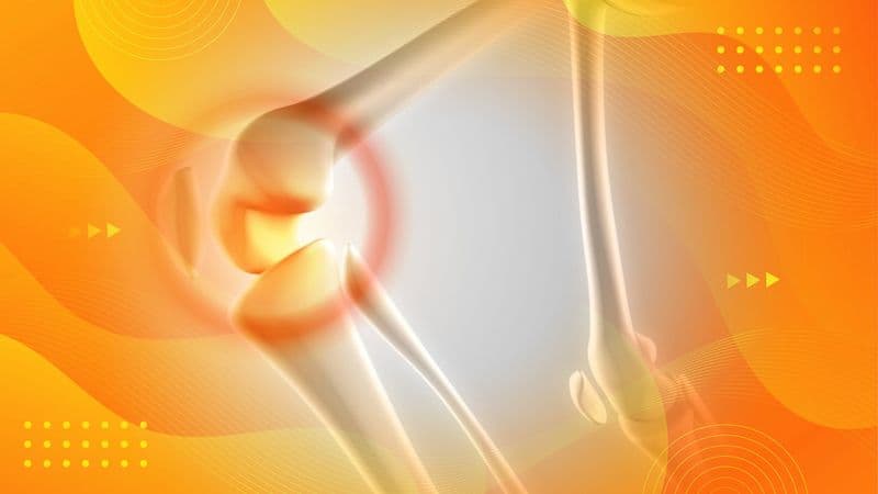 Chipped Kneecap Diagnosis and Recovery