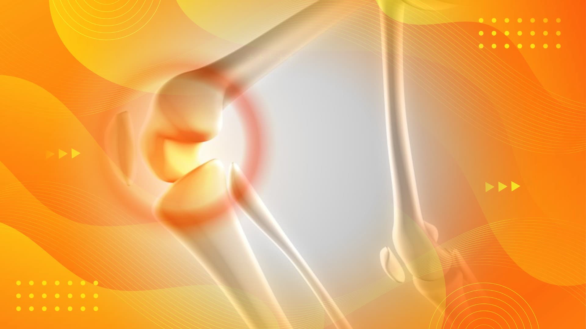 Chipped Kneecap Diagnosis and Recovery