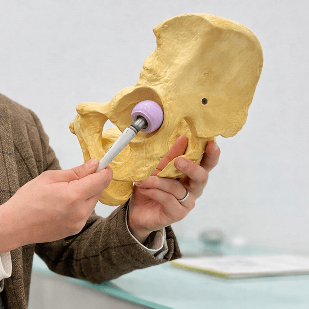 Hip replacement planning and anatomy model