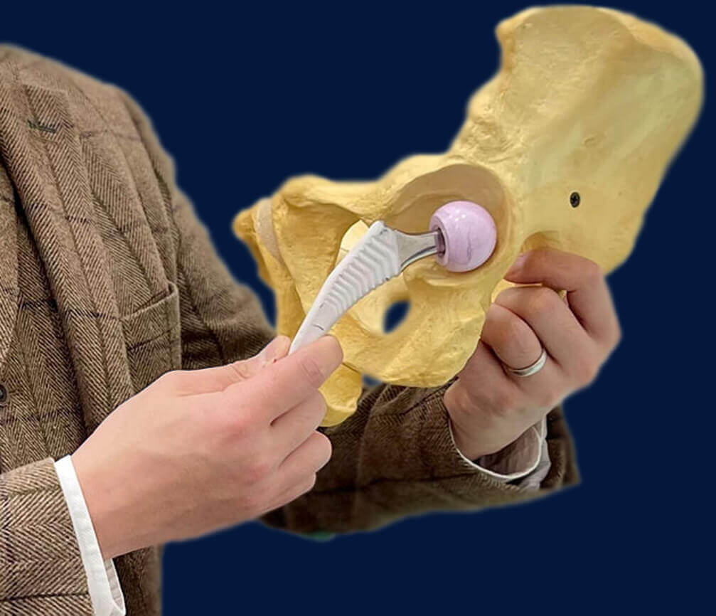 SPAIRE Hip at Lincoln: Unveiling The Tendon-sparing Technique in Detail